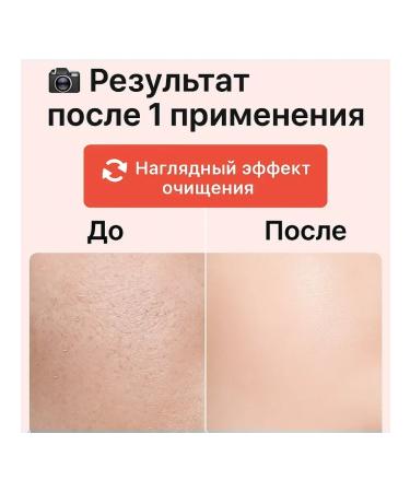 Bema55 Gel-piling for the body - Buy Online on GoSupps.com