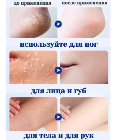 Heel wax 2 pcs. - Buy Online on GoSupps.com