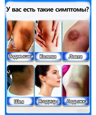 whitening body cream - Buy Online on GoSupps.com