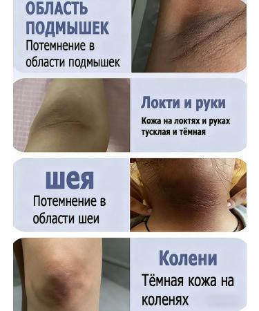 whitening body cream - Buy Online on GoSupps.com