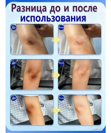 whitening body cream - Buy Online on GoSupps.com