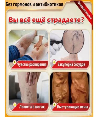 ointment from varicose veins on the legs - Buy Online on GoSupps.com