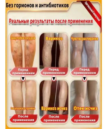 ointment from varicose veins on the legs - Buy Online on GoSupps.com