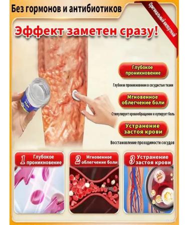 ointment from varicose veins on the legs - Buy Online on GoSupps.com
