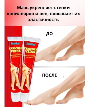Madina I Ointment from varicose veins helps with vasculitis - Buy Online on GoSupps.com