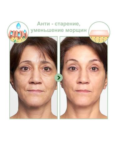 Eelhoe collagen for sleeping from wrinkles 3 pcs - Buy Online on GoSupps.com