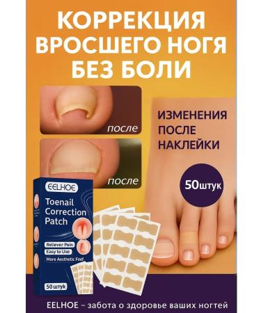 MELUX Plaster for the correction of ingrown nails on the legs