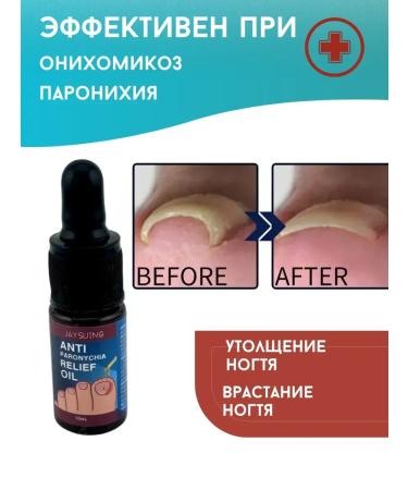 alma2 Oil from an ingrown nail and oholysis panarization fungus - Buy Online on GoSupps.com