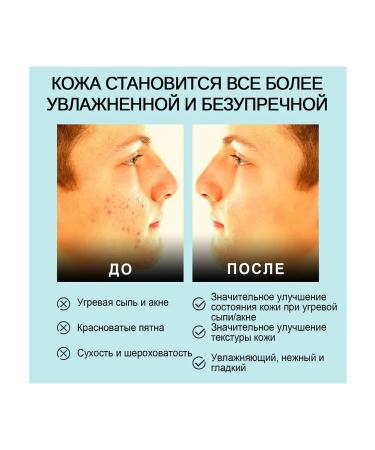 eelhoe Remove ticks soap pure all body pimple excess sebum - Buy Online on GoSupps.com