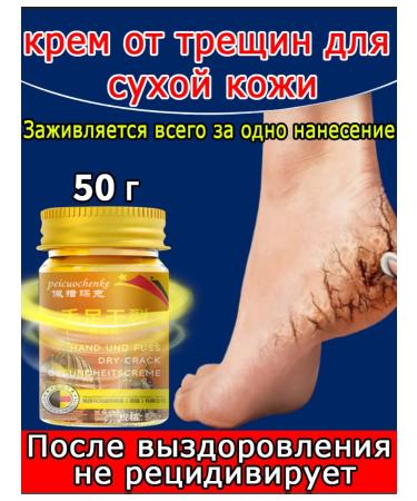 Cream from cracks on heels healing