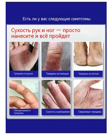 Cream from cracks on heels healing - Buy Online on GoSupps.com