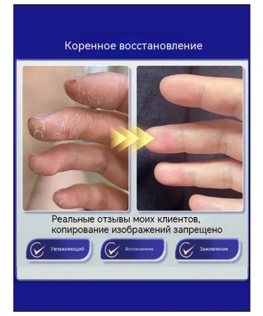 Cream from cracks on heels healing - Buy Online on GoSupps.com