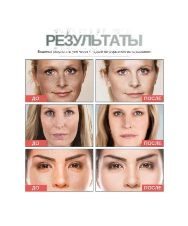 eelhoe Retinol face cream to align wrinkles multiple repairs - Buy Online on GoSupps.com