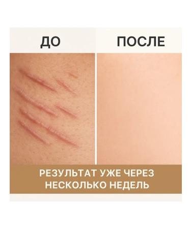 ami77 Medical cream from scars scars and stretch marks 5pcs - Buy Online on GoSupps.com