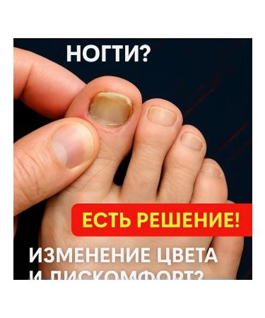 ami77 Remedy for toenail fungus - Buy Online on GoSupps.com