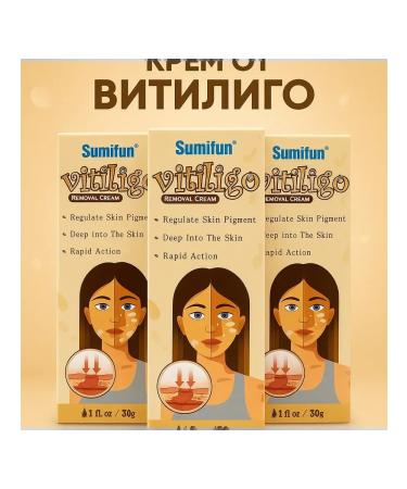 Musya Vitiligo cream for white skin spots