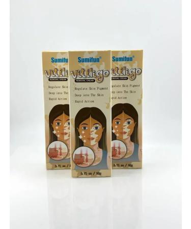 Musya Vitiligo cream for white skin spots - Buy Online on GoSupps.com
