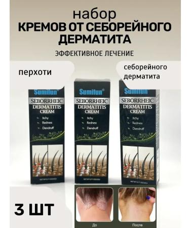Life Ointment from seborrheic dermatitis against it on the head of itching