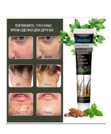 Life Ointment from seborrheic dermatitis against it on the head of itching - Buy Online on GoSupps.com