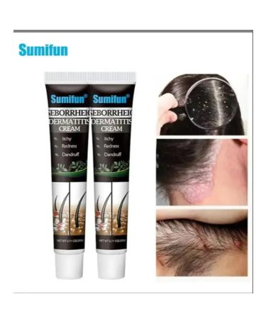 Life Cream ointment from itching dandruff on the head seborrheic dermatitis - Buy Online on GoSupps.com