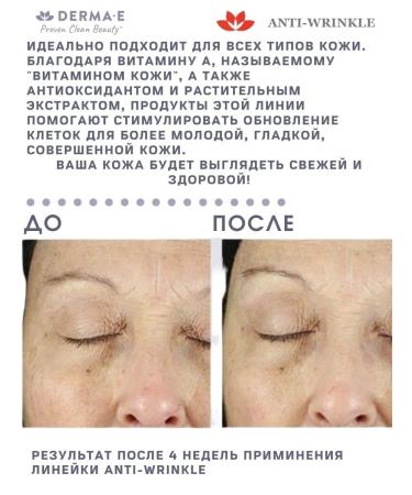 Derma E Face washing gel against wrinkles - Buy Online on GoSupps.com