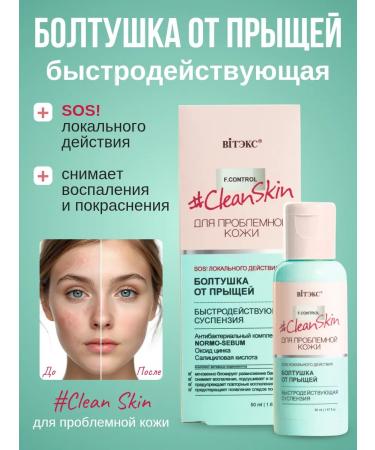 Vitex Suspension chattering acne high -speed