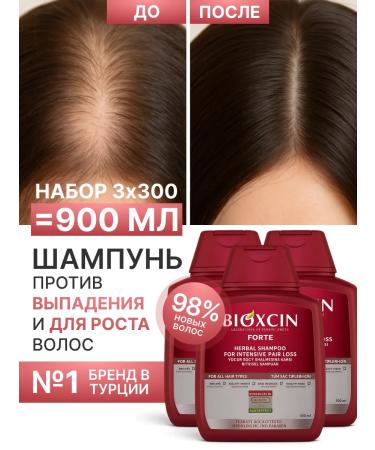 BIOXCIN Hair shampoo from falling out professional