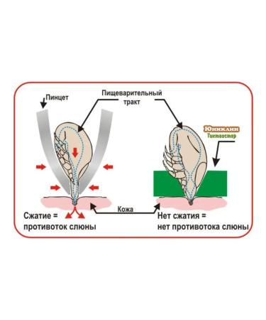 Uniclean Tick twisting auxiliary set - Buy Online on GoSupps.com