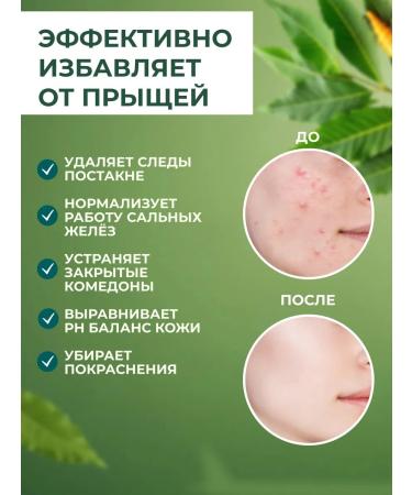 Himalaya Since 1930 Cleansing foam for washing oily skin from acne 150 ml - Buy Online on GoSupps.com