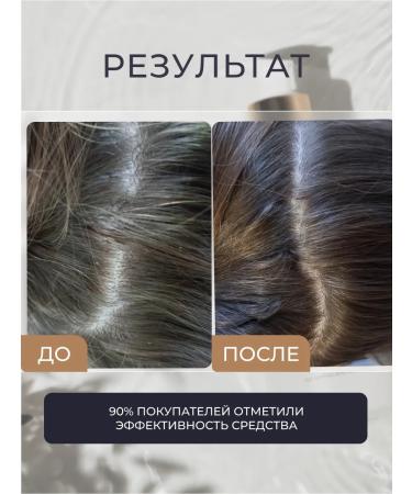 ANNA GALE Salusfantic shampoo for dry scalp - Buy Online on GoSupps.com