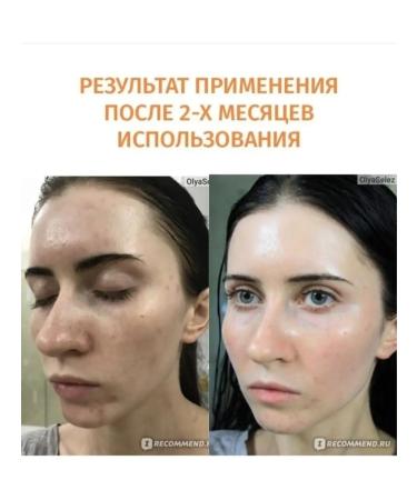 Timeless Vitamin C 20% E Ferulic Acid Serum - Buy Online on GoSupps.com