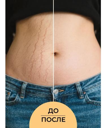 SIBERINA Natural oil against stretch marks - Buy Online on GoSupps.com