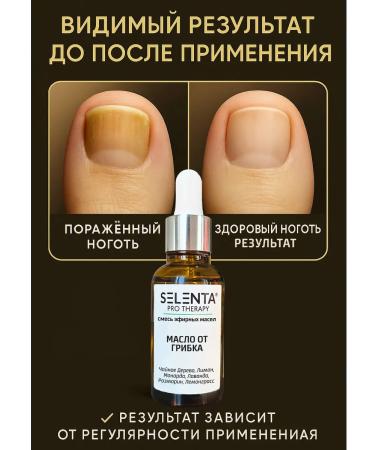 Selenta Oil for nail fungus - Buy Online on GoSupps.com