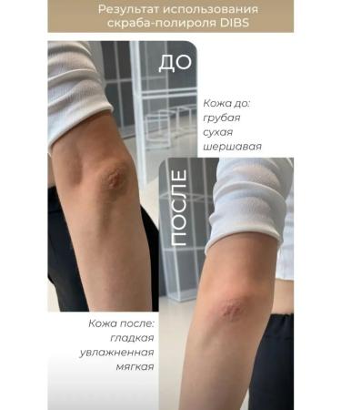 Dibs cosmetics Acid peeling for face and scalp exfoliating cosmetics for hair care cleansing and pore tightening - Buy Online on GoSupps.com