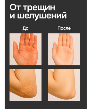 Fu Lie Ling Fulin cream for very dry skin ointment with urea from cracks - Buy Online on GoSupps.com