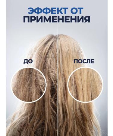 Mama Mia Shop Hair growth activator with baldness 35 ml - Buy Online on GoSupps.com