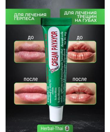 Abhaibhubejhr The healing cream from herpes allergies of the rash of cracks Payayor - Buy Online on GoSupps.com