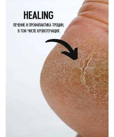 Smart Master Multi Paste Smart from Nail Onicholysis 15 ml - Buy Online on GoSupps.com