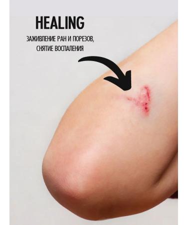 Smart Master Multi Paste Smart from Nail Onicholysis 15 ml - Buy Online on GoSupps.com