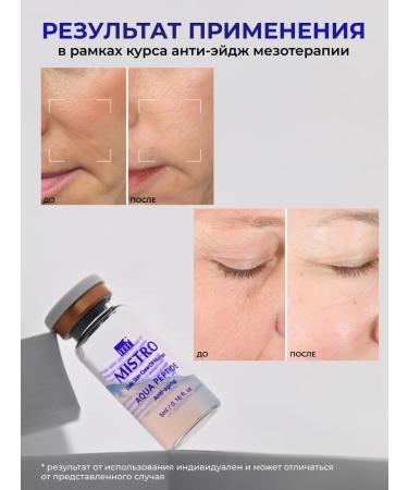 Matrigen Wheezero for the face. Rejuvenating with peptides 5 ml - Buy Online on GoSupps.com