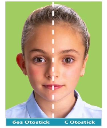 Otostick Transparent proofreaders for ears of an outcome for adults and children - Buy Online on GoSupps.com