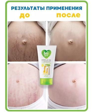 BELITA Eco -scream for body stretch marks for pregnant women - Buy Online on GoSupps.com