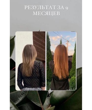 HIPERTIN Hair loss ampoules - Buy Online on GoSupps.com