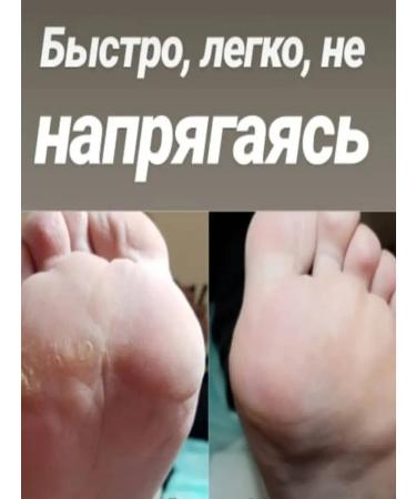 OSAG Exchange sponge for the pedicure disk M-20mm - Buy Online on GoSupps.com