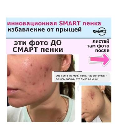 Smart Master Foam for washing with a brush - Buy Online on GoSupps.com