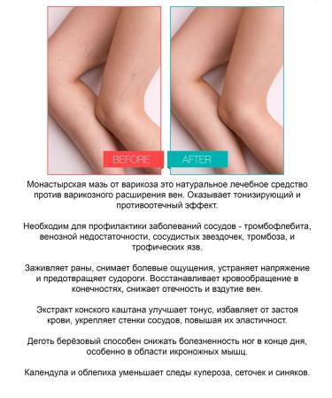 Bizoryuk Natural ointment against varicose veins - Buy Online on GoSupps.com