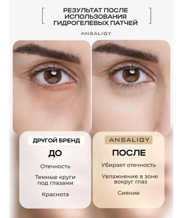 ANSALIGY Paths for the eyes from edema and bags under the eyes of 5 pairs - Buy Online on GoSupps.com