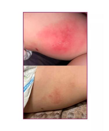 ROSILAK Talc for manicure spraying for legs and skin - Buy Online on GoSupps.com