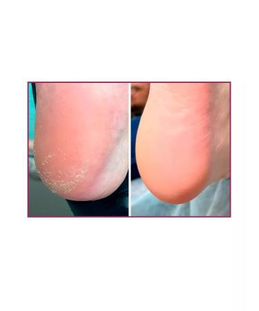 ROSILAK Talc for manicure spraying for legs and skin - Buy Online on GoSupps.com