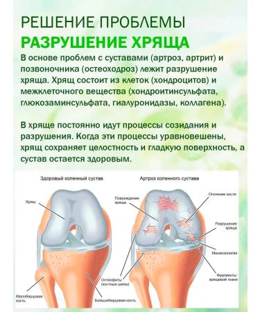 Doctor Bobyr Set of creams asset for joints + No. 1 from back pain and neck - Buy Online on GoSupps.com